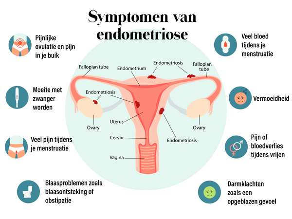 Kun je iets doen tegen endometriose met voeding